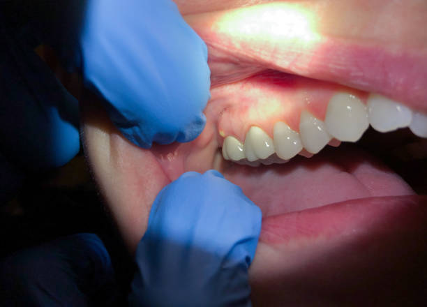 Best Emergency Dentist for Special Needs Patients in Neffs, OH