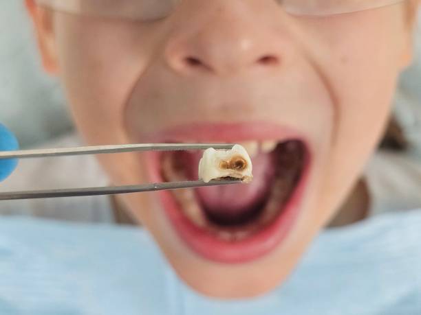 Best Pediatric Emergency Dentist in Neffs, OH